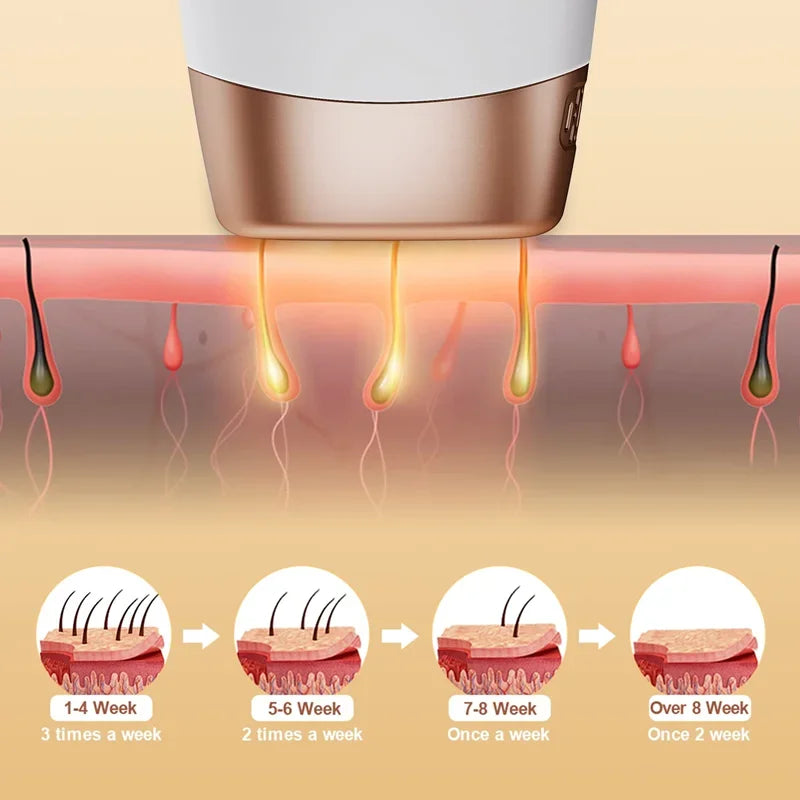 "Aparelho de Depilação Profissional IPL/Laser para Uso Caseiro – Resultados Permanentes e Indolores para Mulheres e Homens"
