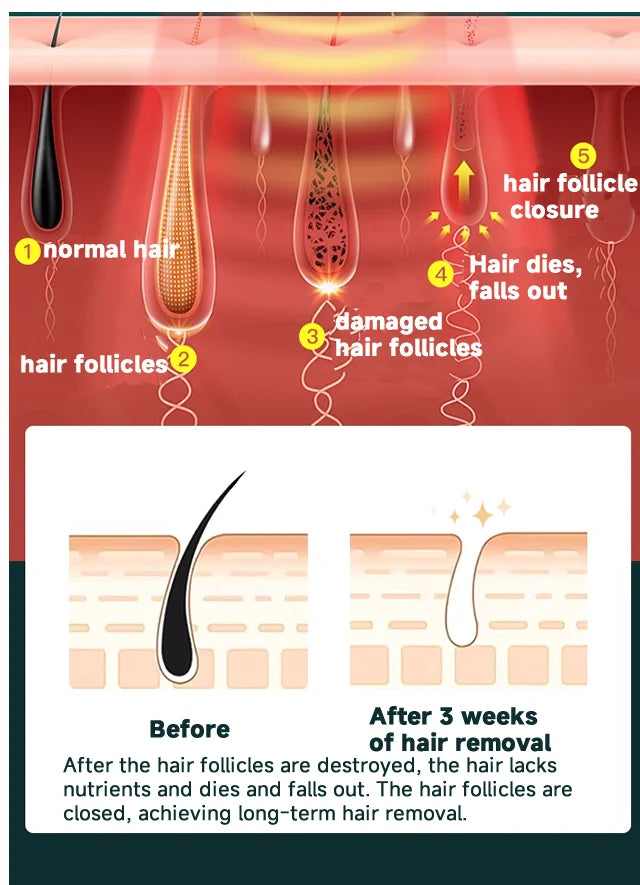 "Aparelho de Depilação Profissional IPL/Laser para Uso Caseiro – Resultados Permanentes e Indolores para Mulheres e Homens"